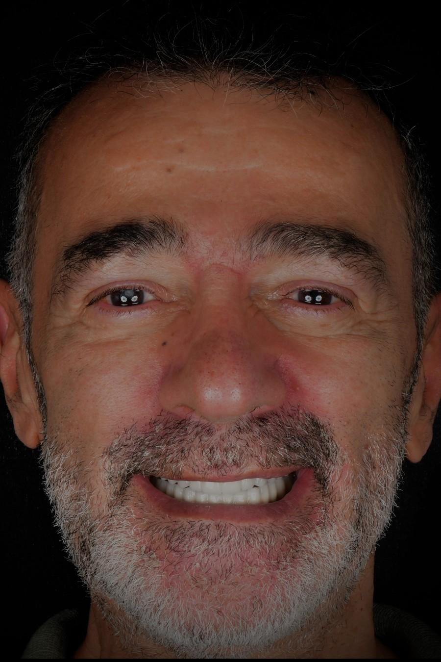Chaiki